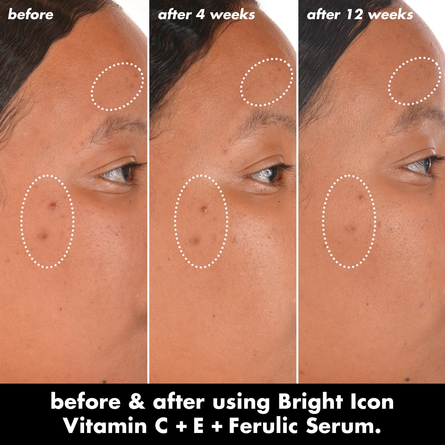 bright-icon-vitamin-c-e-ferulic-serum-v6 0226_EDU_BrightIconVitC_BA_Chanel_TRIPTYCH_c58f2fc8-209d-414f-9ba3-666a07a94887.jpg
