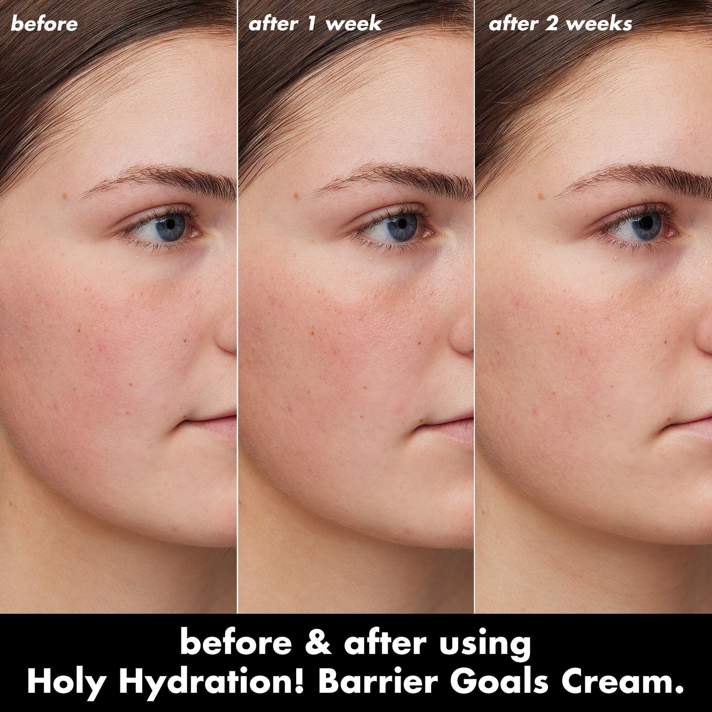 holy-hydration-barrier-goals-cream-s1 0226_EDU_HHBarrierGoalsCream_B_A_Zoe_TRYPTICH_710f5249-3a6b-41fd-89e4-817294dd9258.jpg