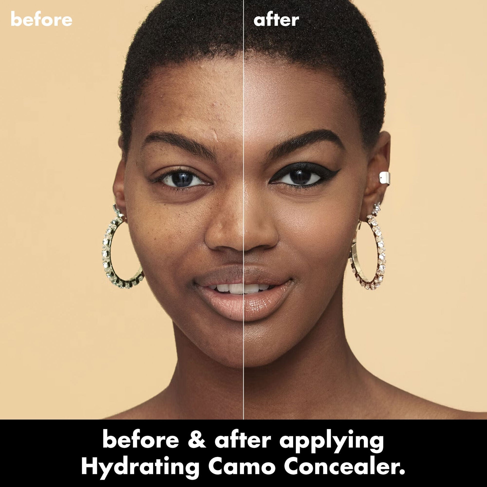 hydrating-camo-concealer-r6 0226_EDU_HydratingCamoConcelaer_BA_AshleyKaresh_20_1_d8499bbf-0e91-4173-b5e2-75127caf83a3.jpg