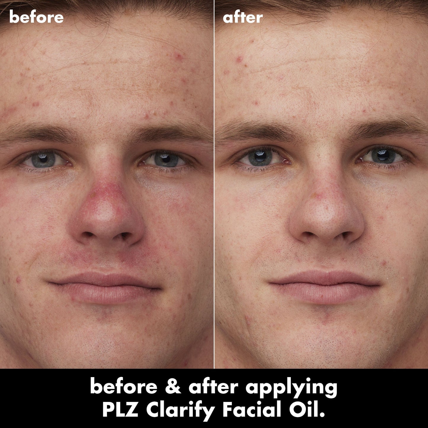 plz-clarify-facial-oil-d2 0326_EDU_PlzClarify_BA_Caleb.jpg