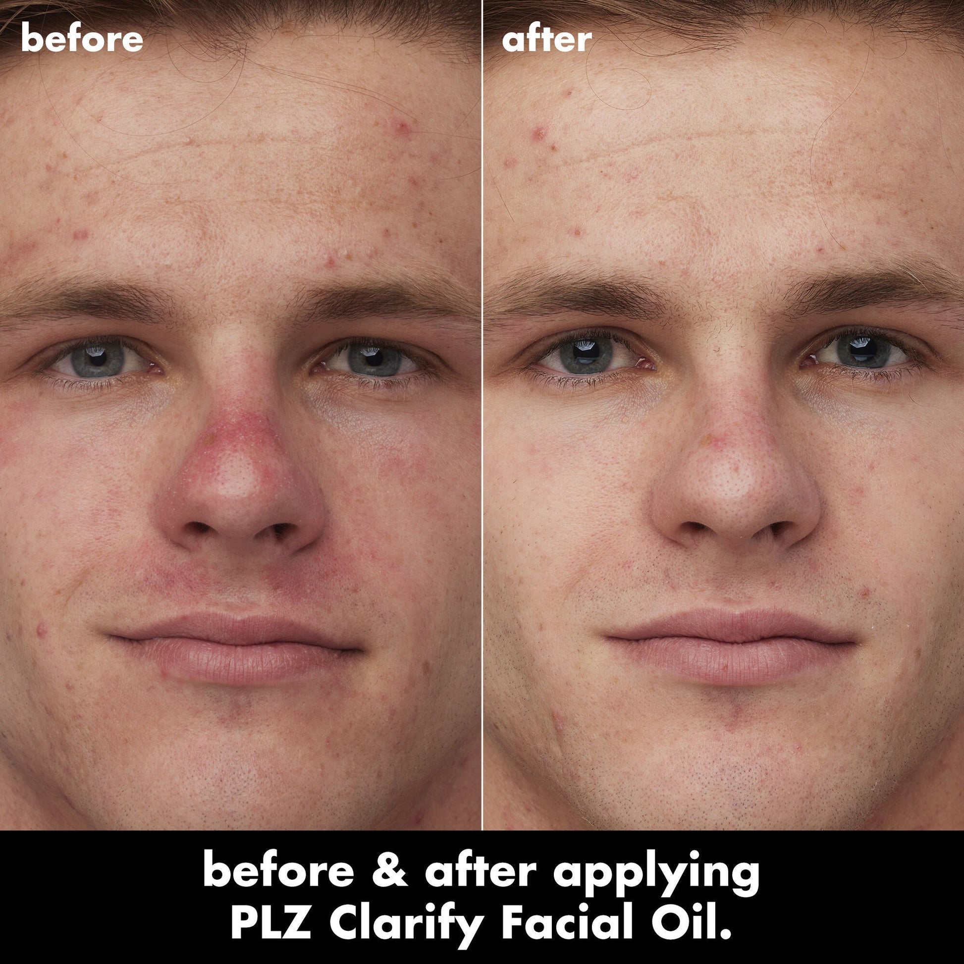 plz-clarify-facial-oil-d2 0326_EDU_PlzClarify_BA_Caleb.jpg