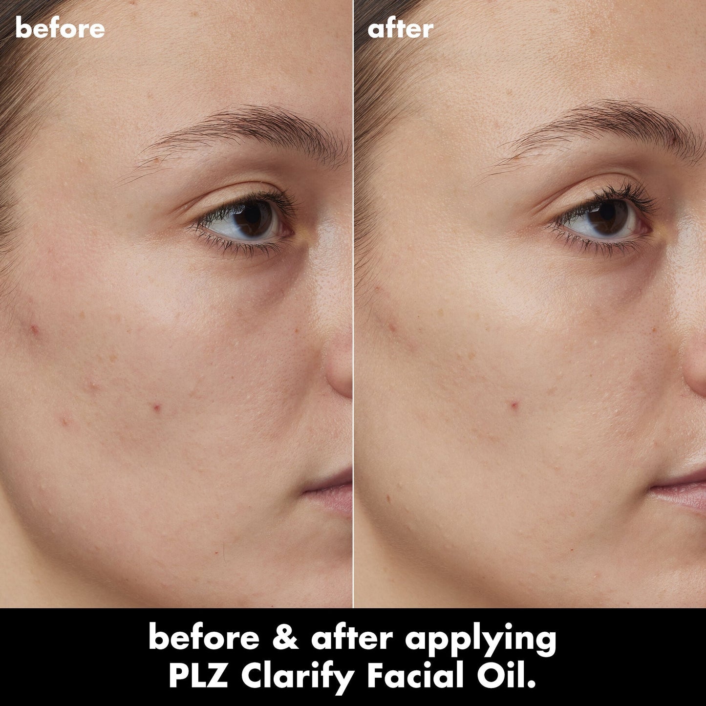 plz-clarify-facial-oil-d2 0326_EDU_PlzClarify_BA_Kelly.jpg