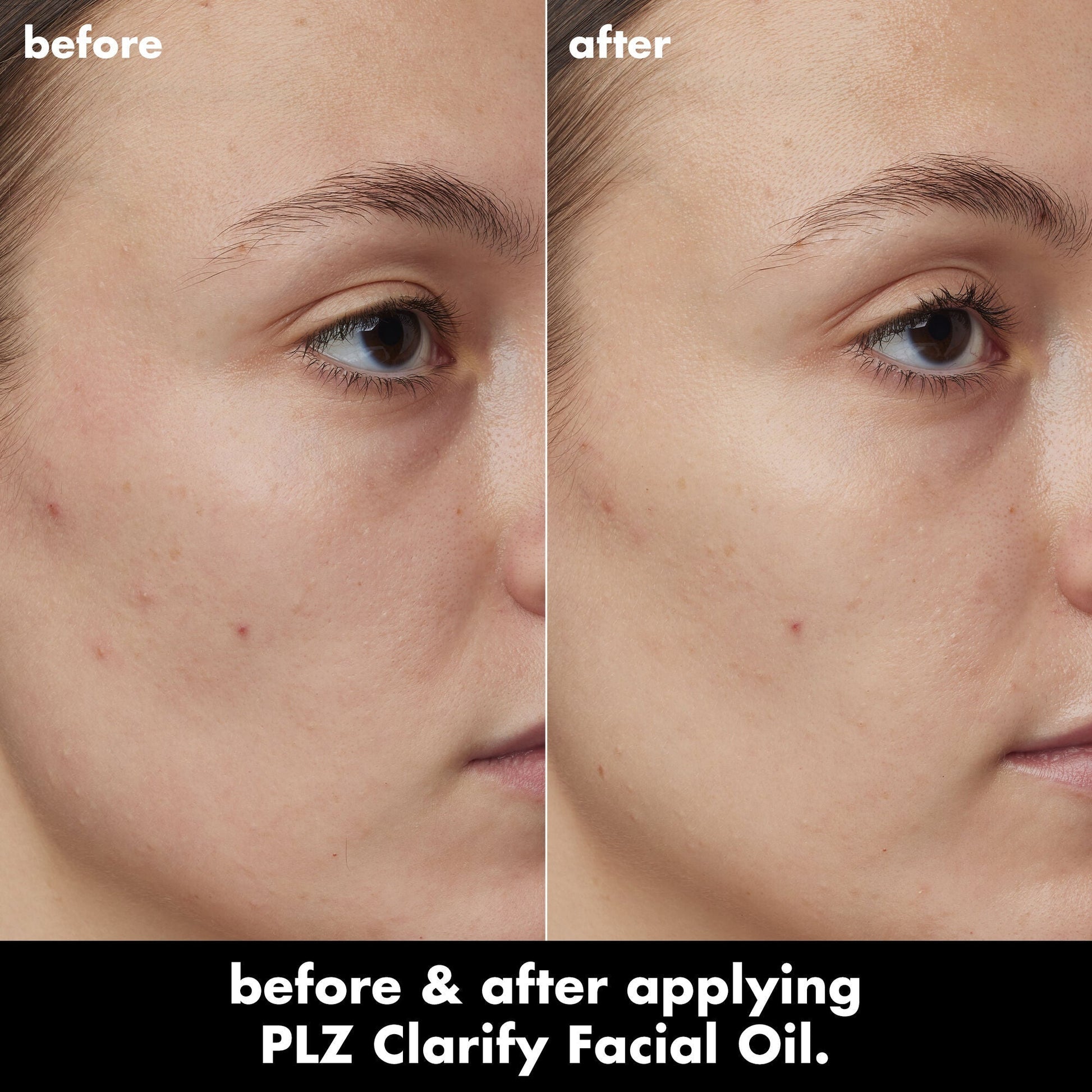 plz-clarify-facial-oil-d2 0326_EDU_PlzClarify_BA_Kelly.jpg