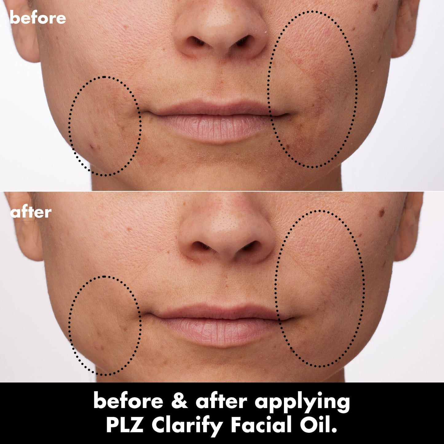 plz-clarify-facial-oil-d2 0326_EDU_PlzClarify_BA_Paula.jpg