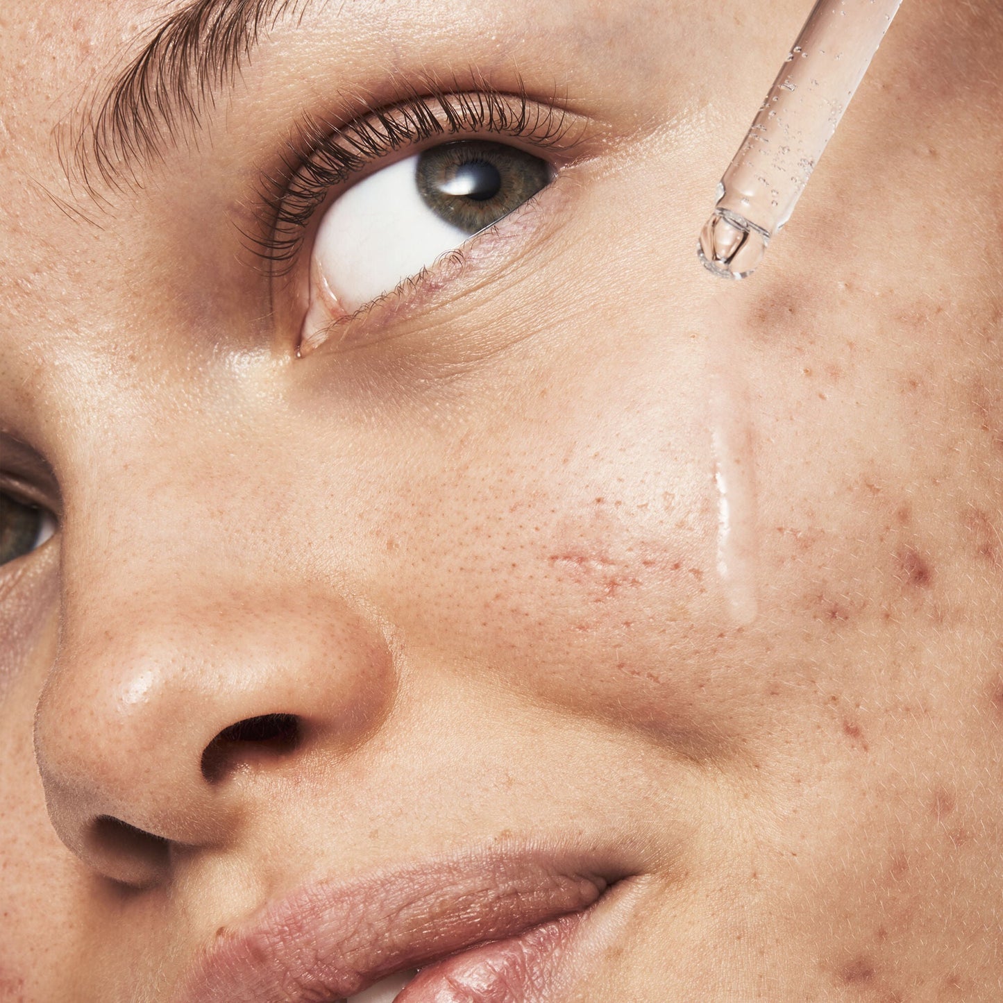 blemish-breakthrough-triple-acid-resurfacing-serum-f6 121321_Marley-Acne-Regimen_0254_FINAL_IGF.jpg
