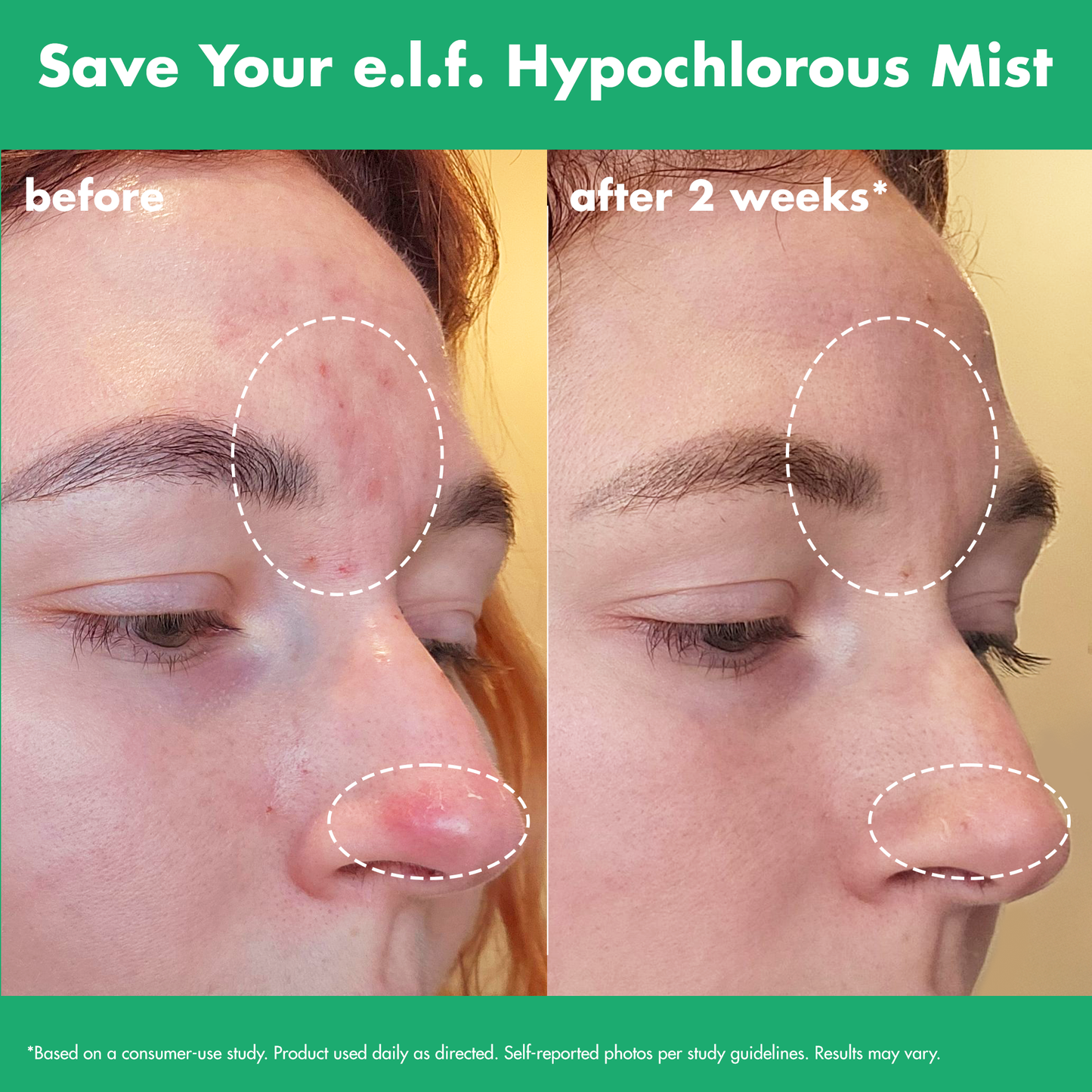 save-your-e-l-f-hypochlorous-mist-x4 FA26_EDUCATION_SAVEYOURELF_USAGE_BA1_WITHOUT_CLAIMS.png