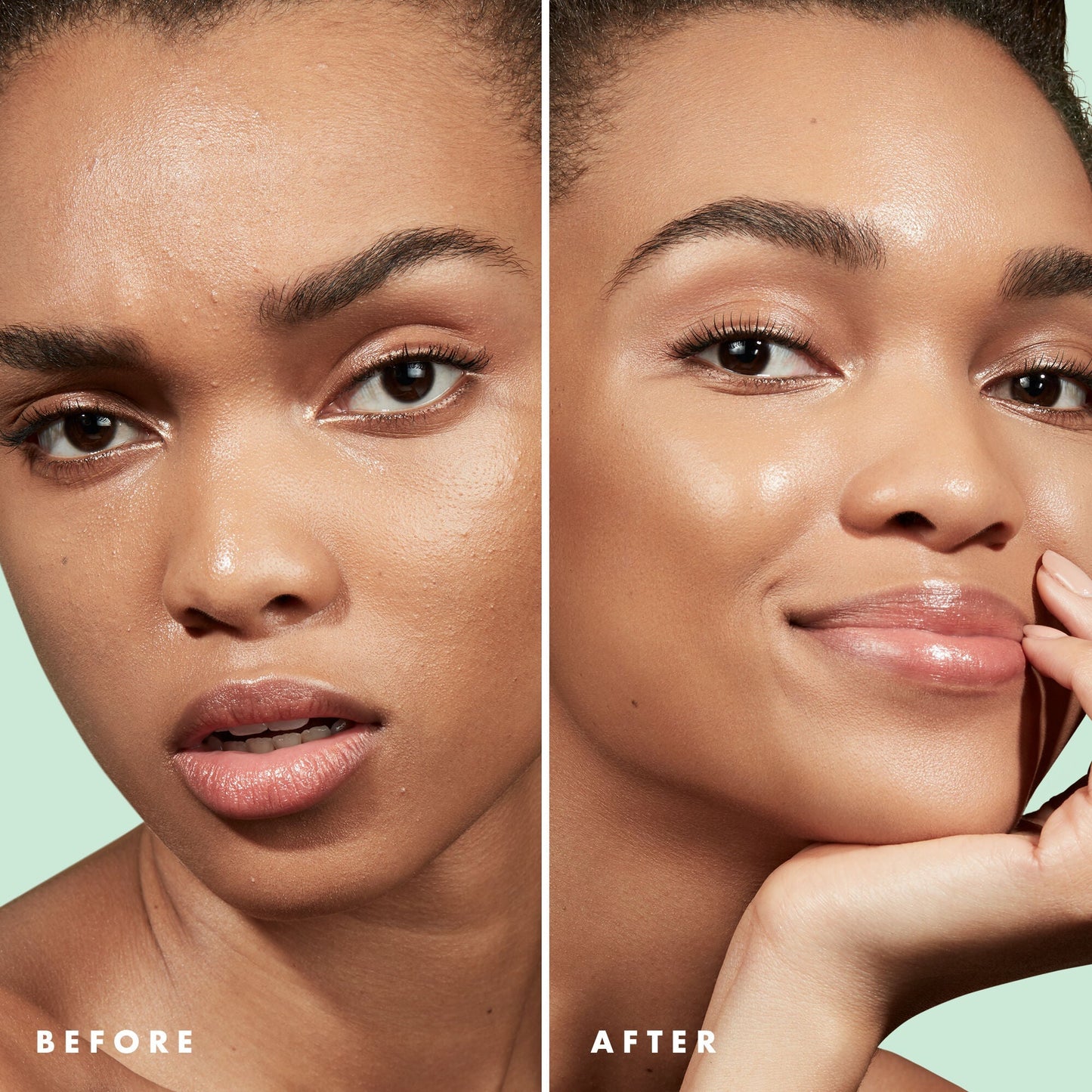 blemish-control-face-primer-small-size-p7 Primer_PP_Before_After_BlemishControl_2000x2000_1b657297-1b62-4427-874a-10c706535581.jpg