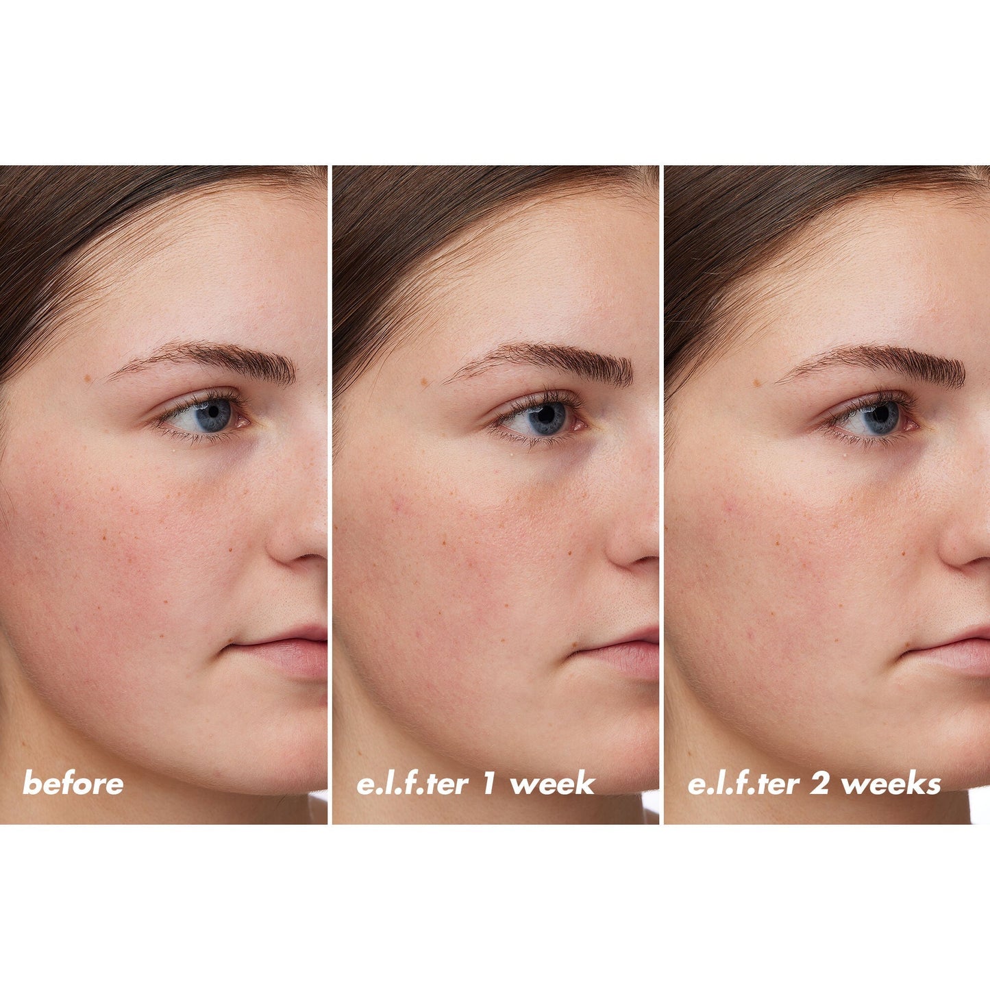 holy-hydration-barrier-goals-cream-regular-v3 XX26_EDUCATION_HH-BarrierGoals_B_A_Zoe_TRYPTICH_74c905bd-67bd-4b91-b633-2b01a8905cb8.jpg